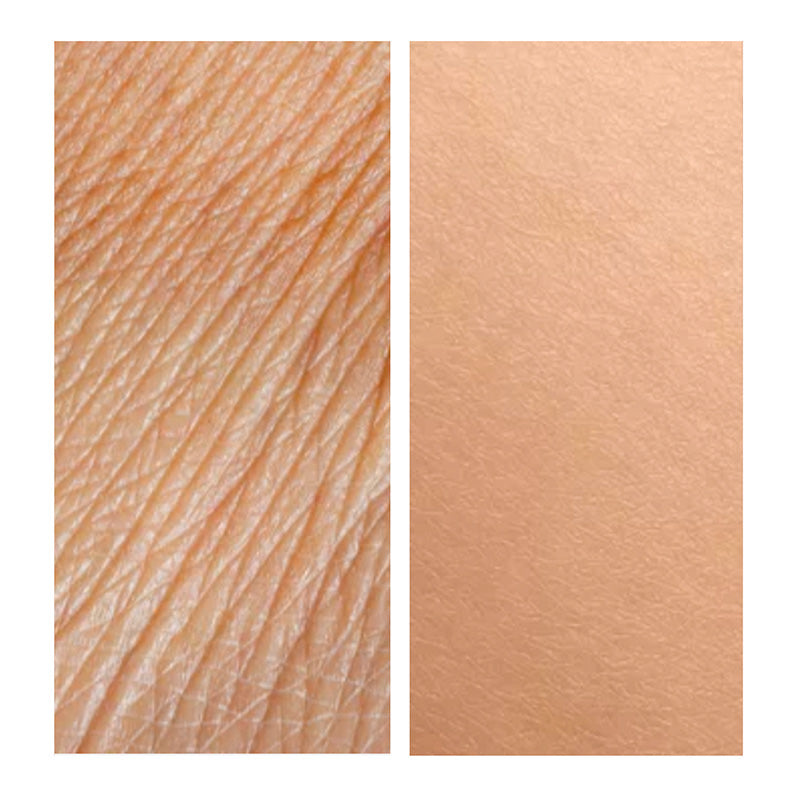 Anti-Aging