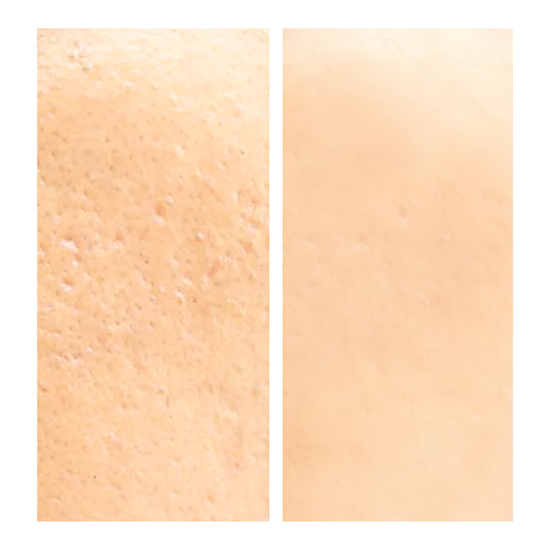 Exfoliants