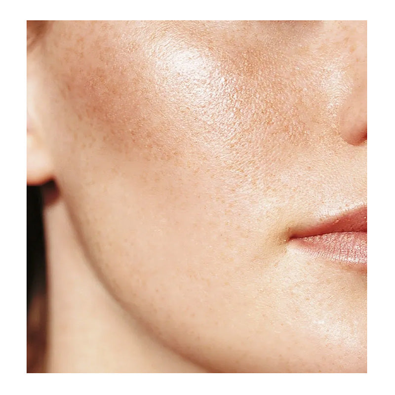 Collagen Production
