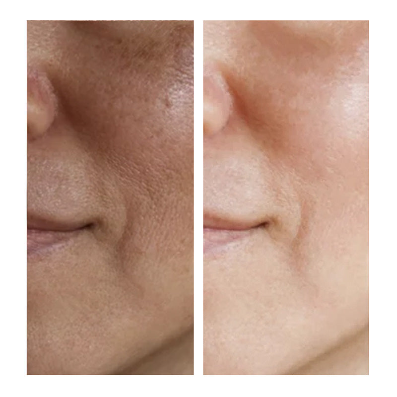 Skin Brightening