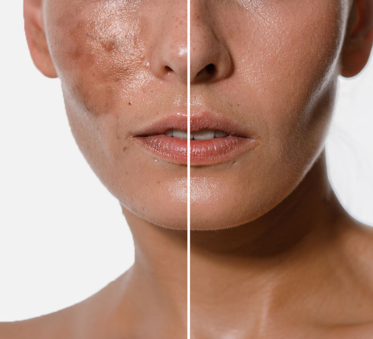 Hyaluronic Acid Hydrated, Plump Skin Royal Labs Natural Cosmetics, Inc.